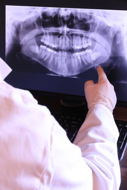Best Emergency Treatment for Dental Infections or Abscesses in Taylor Mill, KY
